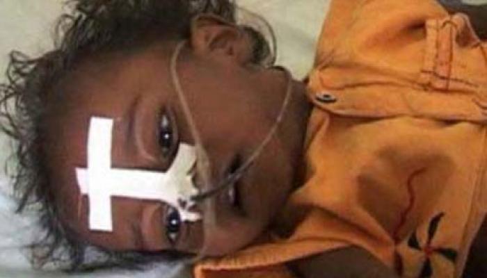 এনসেফ্যালাইটিসে উত্তরবঙ্গে মৃতের সংখ্যা ১২৪ এনসেফ্যালাইটিসে উত্তরবঙ্গে মৃতের সংখ্যা ১২৪