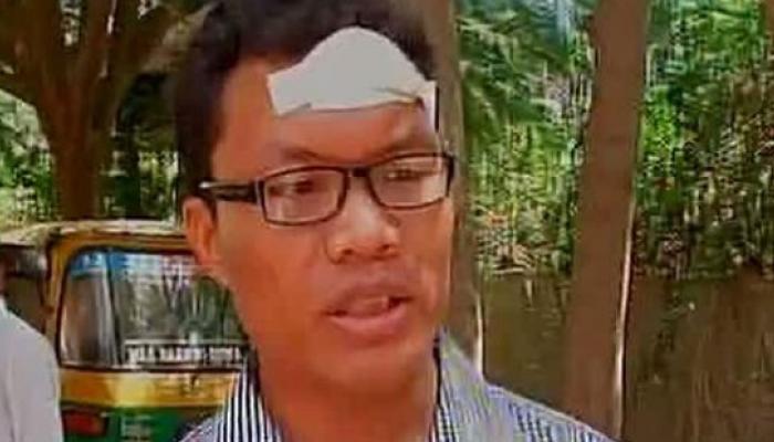 কন্নড় বলতে না পারায় বেঙ্গালুরুতে আক্রান্ত মনিপুরের ছাত্র কন্নড় বলতে না পারায় বেঙ্গালুরুতে আক্রান্ত মনিপুরের ছাত্র