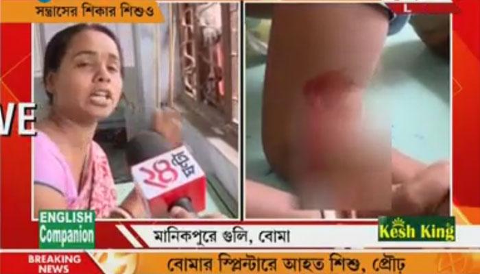সন্ত্রাসের শিকার ২ বছরের শিশু, বোমার স্প্লিন্টার ও গুলিতে আহত ৪ সন্ত্রাসের শিকার ২ বছরের শিশু, বোমার স্প্লিন্টার ও গুলিতে আহত ৪