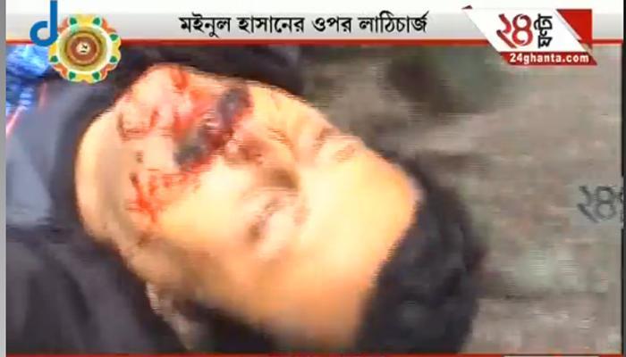 সিপিএমের প্রাক্তন সাংসদ মইনুলের বিরুদ্ধে সরকারি সম্পত্তি নষ্টের মামলা সিপিএমের প্রাক্তন সাংসদ মইনুলের বিরুদ্ধে সরকারি সম্পত্তি নষ্টের মামলা