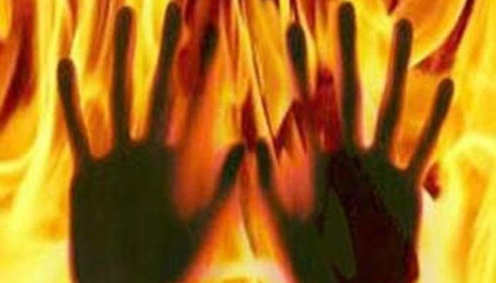 বিয়ের প্রস্তাবে রাজি না হওয়ায় যুবতীর গায়ে আগুন বিয়ের প্রস্তাবে রাজি না হওয়ায় যুবতীর গায়ে আগুন