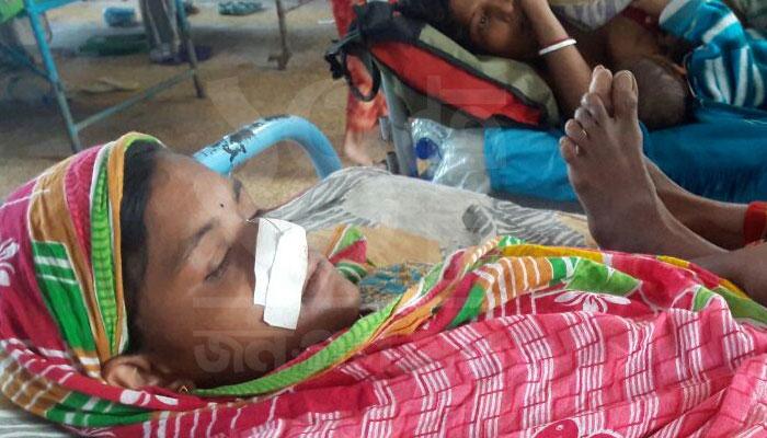 পরিবার কোন্দলে নাক গলাতে গিয়ে নাক কাটা গেল বাড়ির মেয়ের পরিবার কোন্দলে নাক গলাতে গিয়ে নাক কাটা গেল বাড়ির মেয়ের