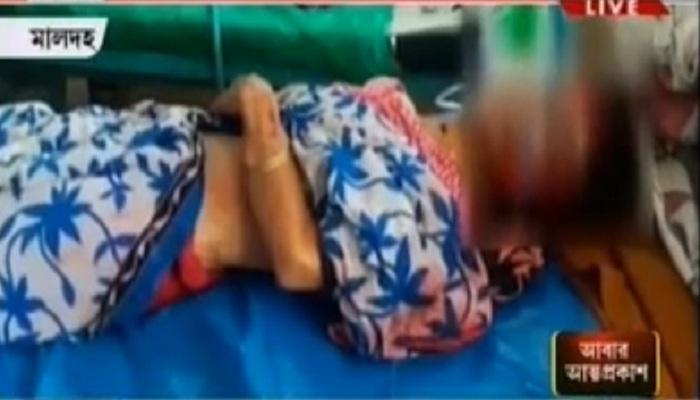 মালদায় মা ও প্রতিবন্ধী মেয়েকে মাথা থেঁতলে খুনের চেষ্টা, বেপাত্তা কাকা মালদায় মা ও প্রতিবন্ধী মেয়েকে মাথা থেঁতলে খুনের চেষ্টা, বেপাত্তা কাকা