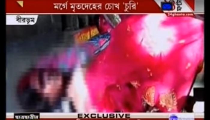 মর্গ থেকে চুরি গেল মৃতদেহের চোখ, তুলকালাম হাসপাতালে মর্গ থেকে চুরি গেল মৃতদেহের চোখ, তুলকালাম হাসপাতালে
