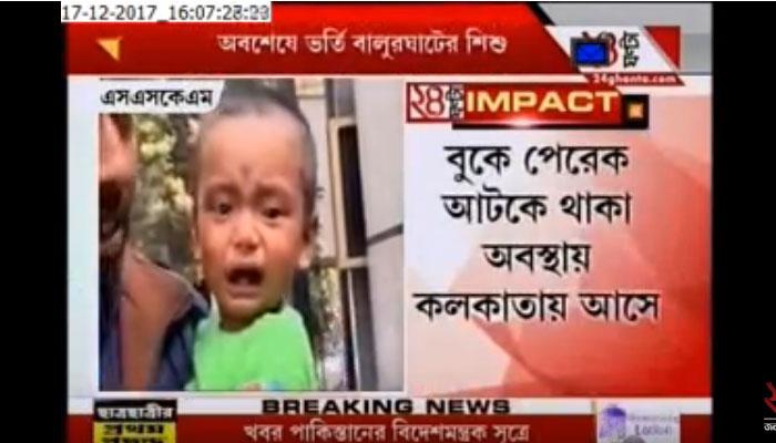 বুকে আটকে পেরেক, তিন-তিনটে হাসপাতাল ঘুরে অবশেষে চিকিত্সা শিশুর বুকে আটকে পেরেক, তিন-তিনটে হাসপাতাল ঘুরে অবশেষে চিকিত্সা শিশুর