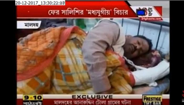 জমি নিয়ে বিবাদ, সালিশিতে হাত কেটে নেওয়ার নিদান! জমি নিয়ে বিবাদ, সালিশিতে হাত কেটে নেওয়ার নিদান!