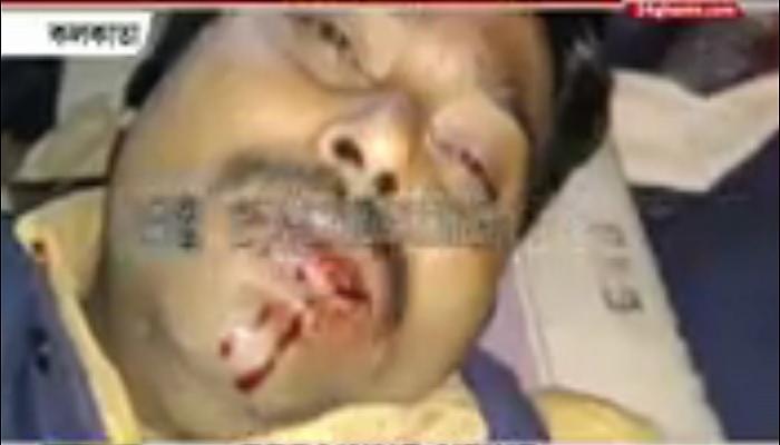 পোস্তায় গেস্টহাউসে ঢুকে বিজেপি কর্মীদের মারধরের অভিযোগ তৃণমূলের বিরুদ্ধে পোস্তায় গেস্টহাউসে ঢুকে বিজেপি কর্মীদের মারধরের অভিযোগ তৃণমূলের বিরুদ্ধে