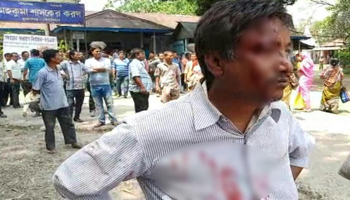 তুফানগঞ্জে ঝরল রক্ত, বিজেপি প্রার্থীকে আক্রমণ তৃণমূলের তুফানগঞ্জে ঝরল রক্ত, বিজেপি প্রার্থীকে আক্রমণ তৃণমূলের