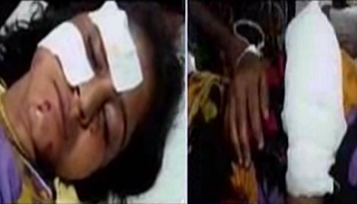 উনুনে লুকানো বোমা, আঁচ দিতেই বিস্ফোরণে উড়ল গৃহবধূর হাত উনুনে লুকানো বোমা, আঁচ দিতেই বিস্ফোরণে উড়ল গৃহবধূর হাত