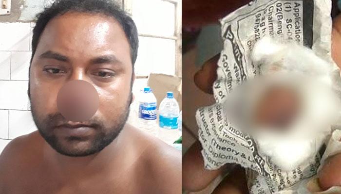 কামড়ে ছিঁড়ে নেওয়া হল তৃণমূল কর্মীর নাক! কামড়ে ছিঁড়ে নেওয়া হল তৃণমূল কর্মীর নাক!
