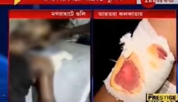 ভোট পরবর্তী অশান্তি: মগরাহাটে এলোপাথাড়ি গুলিতে আহত ৬, আক্রান্ত পুলিস ভোট পরবর্তী অশান্তি: মগরাহাটে এলোপাথাড়ি গুলিতে আহত ৬, আক্রান্ত পুলিস